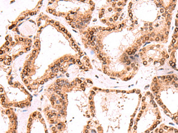 TOR1AIP1 Polyclonal Antibody – Figure 1 of 2