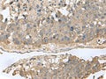 GABARAPL2 Polyclonal Antibody – Figure 1 of 2