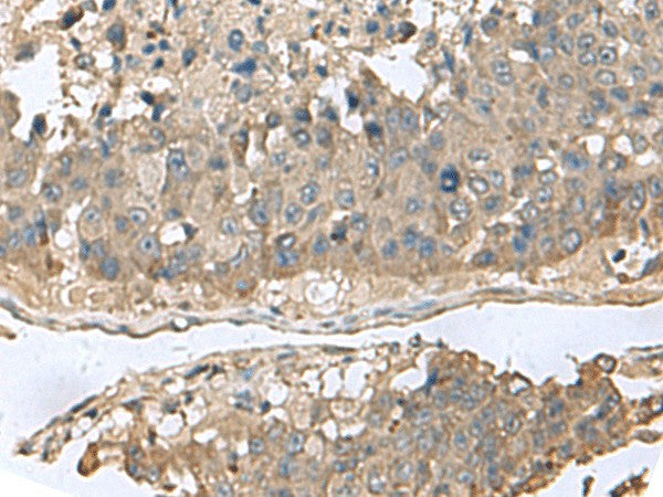 GABARAPL2 Polyclonal Antibody – Figure 1 of 2