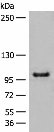 CTDP1 Polyclonal Antibody – Figure 1 of 4