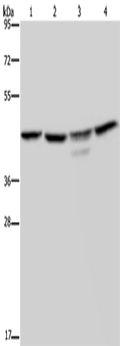CSNK2A1 Polyclonal Antibody – Figure 1 of 3