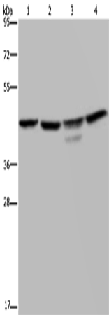 CSNK2A1 Polyclonal Antibody – Figure 1 of 3