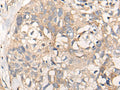 NREP Polyclonal Antibody – Figure 1 of 3