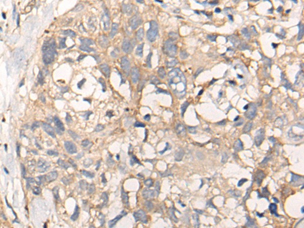 NREP Polyclonal Antibody – Figure 1 of 3