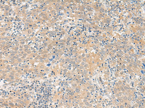 GALP Polyclonal Antibody – Figure 1 of 2