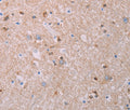 AKT2 Polyclonal Antibody – Figure 1 of 3