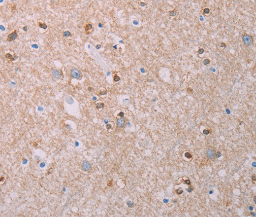AKT2 Polyclonal Antibody – Figure 1 of 3