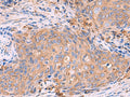 G6PC Polyclonal Antibody – Figure 1 of 3