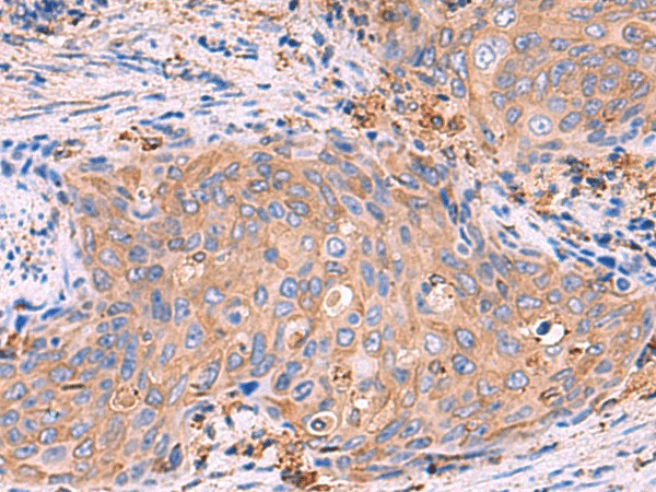 G6PC Polyclonal Antibody – Figure 1 of 3