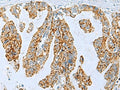 PYCR2 Polyclonal Antibody – Figure 1 of 3