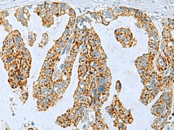 PYCR2 Polyclonal Antibody – Figure 1 of 3