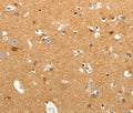 TNR Polyclonal Antibody – Figure 1 of 3