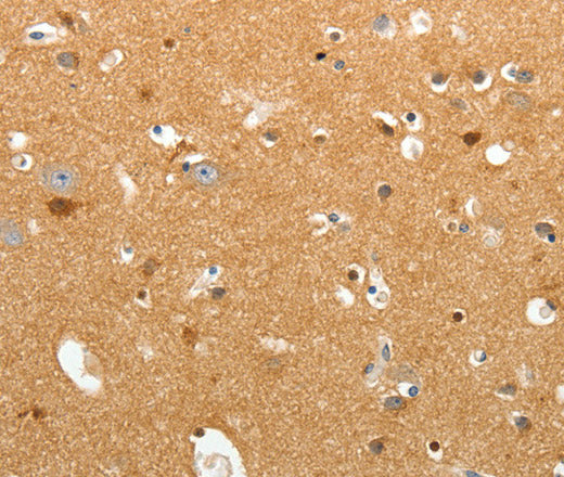 TNR Polyclonal Antibody – Figure 1 of 3