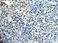DDX39A Polyclonal Antibody – Figure 1 of 3