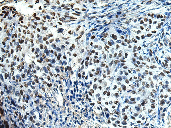 DDX39A Polyclonal Antibody – Figure 1 of 3