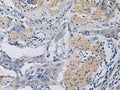KLF1 Polyclonal Antibody – Figure 1 of 3