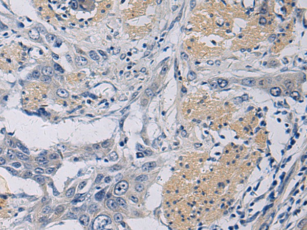 KLF1 Polyclonal Antibody – Figure 1 of 3
