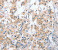 OX2R Polyclonal Antibody – Figure 1 of 3