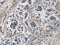 GRIK2 Polyclonal Antibody – Figure 1 of 2