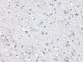 METTL7A Polyclonal Antibody – Figure 1 of 3