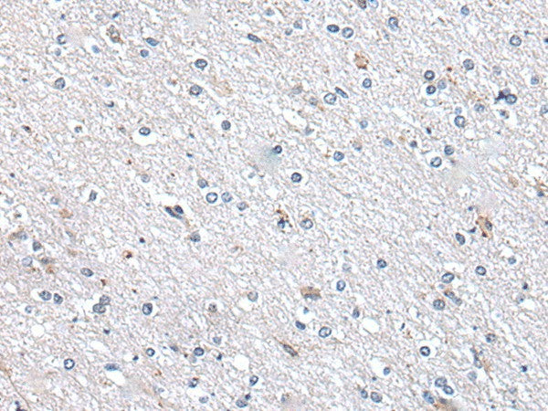 METTL7A Polyclonal Antibody – Figure 1 of 3