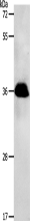 PPP2CB Polyclonal Antibody – Figure 1 of 3