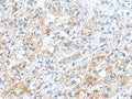 DNAL1 Polyclonal Antibody – Figure 1 of 2