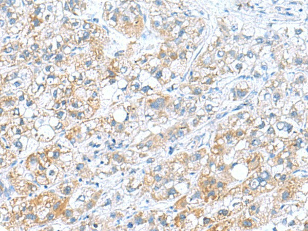 DNAL1 Polyclonal Antibody – Figure 1 of 2