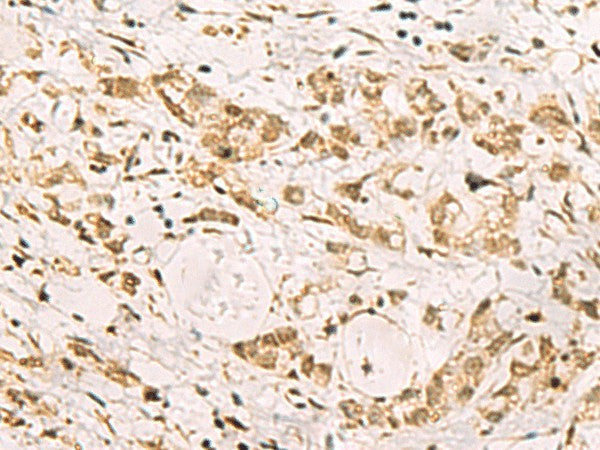 PDS5A Polyclonal Antibody – Figure 1 of 3