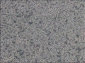 Namalwa cell
