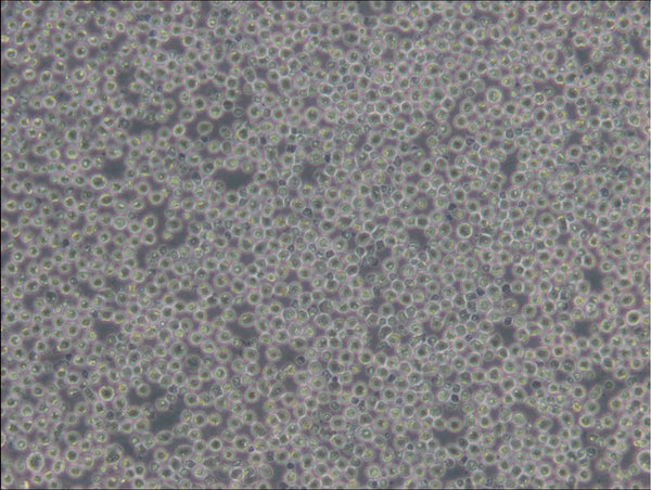 Namalwa cell