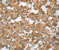 MMP12 Polyclonal Antibody – Figure 1 of 3