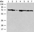 HSPA2 Polyclonal Antibody – Figure 1 of 2
