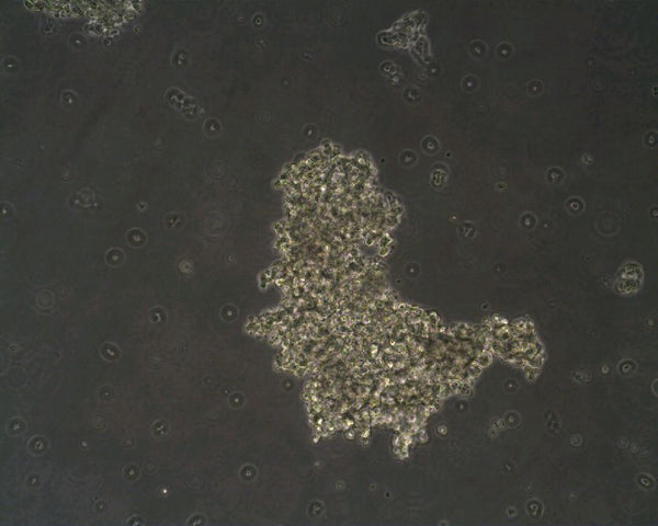 NCI-H209 cell
