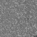 NCI-H226 cell