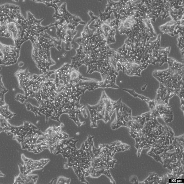 NCI-H295R cell
