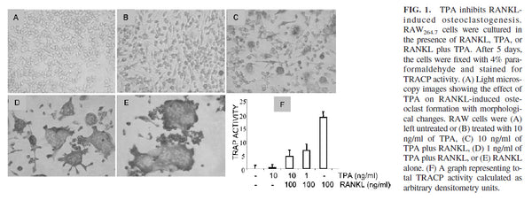 NF-κB Luciferase Stable RAW264.7 Cell Line | Applied Biological Materials (abm)