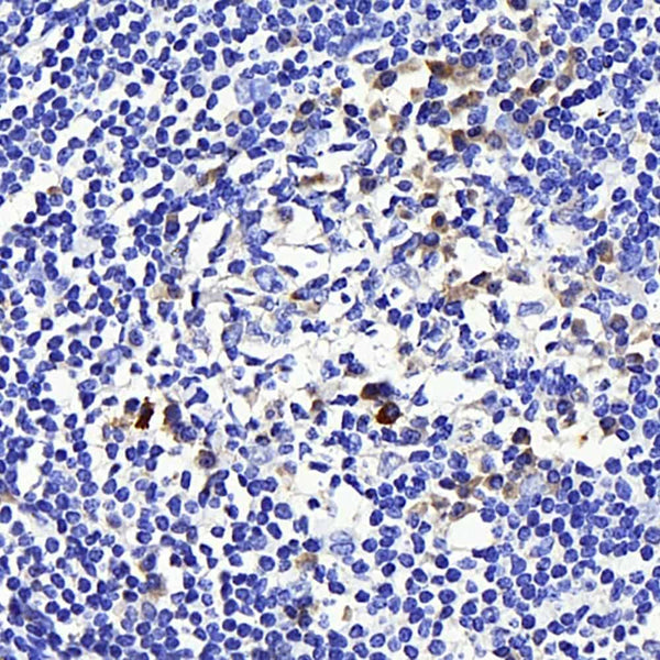 CD169 Polyclonal Antibody – Figure 1 of 3