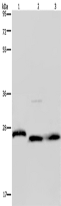 GSTP1 Polyclonal Antibody – Figure 1 of 4