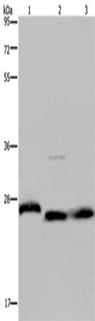 GSTP1 Polyclonal Antibody – Figure 1 of 4