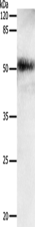 EDA Polyclonal Antibody – Figure 1 of 4
