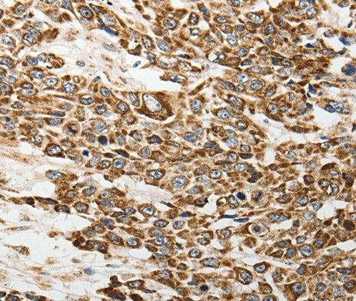 E-Selectin Polyclonal Antibody – Figure 1 of 3