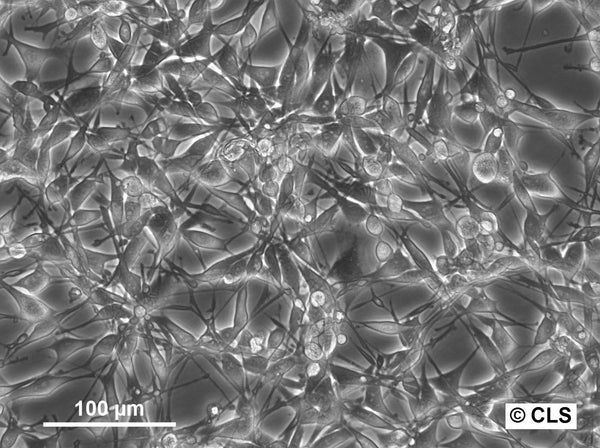 NIH-3T3-ras cell