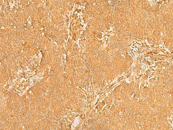 KRT76 Polyclonal Antibody – Figure 1 of 3