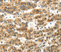 PAPPA Polyclonal Antibody – Figure 1 of 4
