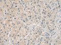 WFDC3 Polyclonal Antibody – Figure 1 of 3