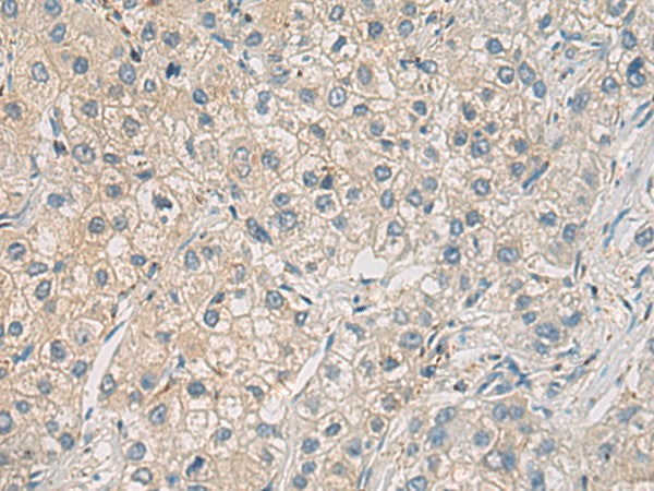 WFDC3 Polyclonal Antibody – Figure 1 of 3