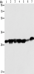 AK2 Polyclonal Antibody – Figure 1 of 4