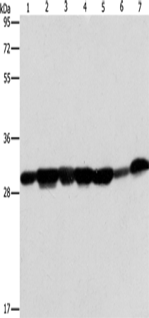 AK2 Polyclonal Antibody – Figure 1 of 4