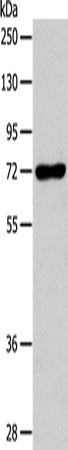 CD218b Polyclonal Antibody – Figure 1 of 2